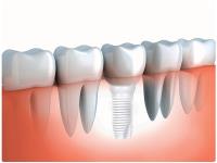 Zen Dental Group image 6